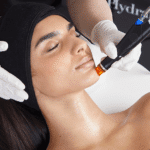 hydrafacial in Lethbridge and southern Alberta