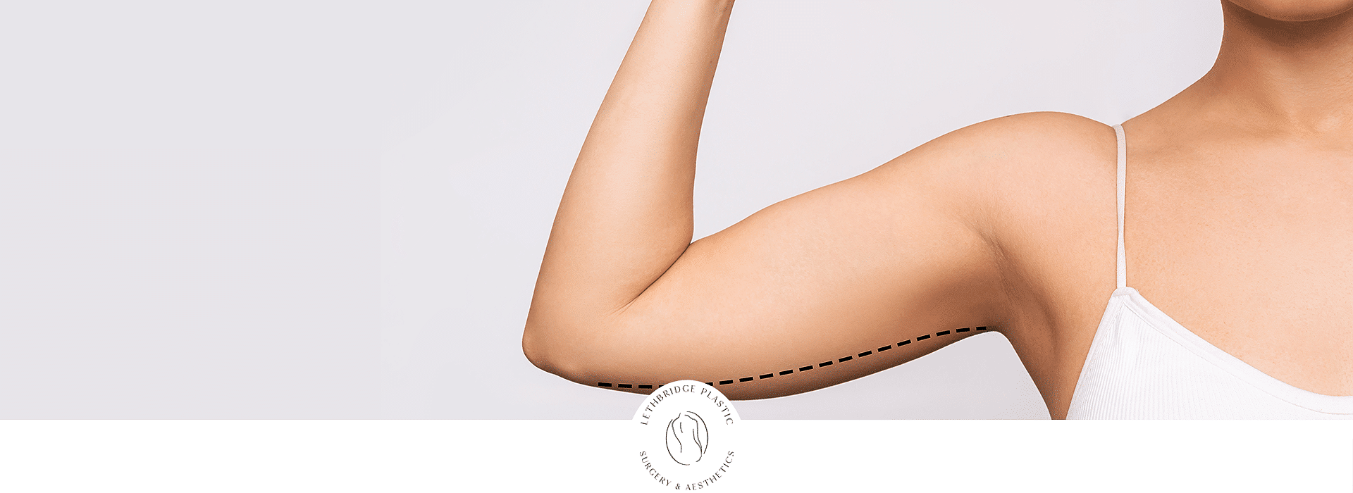 arm lift surgery after weight loss